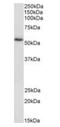 HIP-55 antibody, orb18660, Biorbyt, Western Blot image 