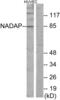 Solute Carrier Family 4 Member 1 Adaptor Protein antibody, abx013777, Abbexa, Western Blot image 