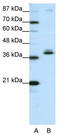 Zinc Finger Protein 25 antibody, TA345513, Origene, Western Blot image 