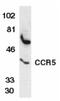 C-C Motif Chemokine Receptor 5 (Gene/Pseudogene) antibody, AHP568, Bio-Rad (formerly AbD Serotec) , Western Blot image 