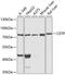 Cholesteryl Ester Transfer Protein antibody, 15-063, ProSci, Western Blot image 