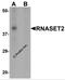 Ribonuclease T2 antibody, 6763, ProSci, Western Blot image 