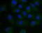 Presenilin Enhancer, Gamma-Secretase Subunit antibody, A04504-1, Boster Biological Technology, Immunocytochemistry image 