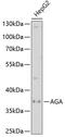 N(4)-(beta-N-acetylglucosaminyl)-L-asparaginase antibody, GTX30031, GeneTex, Western Blot image 