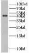 Ras Related GTP Binding B antibody, FNab07488, FineTest, Western Blot image 