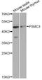 Proteasome 26S Subunit, ATPase 3 antibody, A1986, ABclonal Technology, Western Blot image 