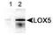 Arachidonate 5-lipoxygenase antibody, TA336528, Origene, Western Blot image 