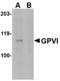 GP6 antibody, LS-C83911, Lifespan Biosciences, Western Blot image 