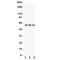 Dopamine Receptor D5 antibody, R31327, NSJ Bioreagents, Western Blot image 