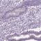 Chromosome 20 Open Reading Frame 144 antibody, PA5-53895, Invitrogen Antibodies, Immunohistochemistry frozen image 
