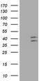 Ornithine Carbamoyltransferase antibody, TA802453, Origene, Western Blot image 