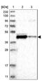 Mitochondrial Fission Regulator 2 antibody, NBP1-84967, Novus Biologicals, Western Blot image 