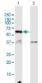 Chromosome 12 Open Reading Frame 40 antibody, H00283461-B01P, Novus Biologicals, Western Blot image 