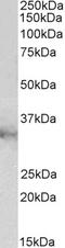 Chloride Intracellular Channel 1 antibody, TA326745, Origene, Western Blot image 