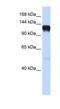EPH Receptor A5 antibody, NBP1-53105, Novus Biologicals, Western Blot image 