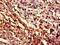 Myocyte Enhancer Factor 2D antibody, CSB-PA613522LA01HU, Cusabio, Immunohistochemistry paraffin image 