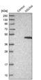 NOP2/Sun RNA Methyltransferase 4 antibody, PA5-55876, Invitrogen Antibodies, Western Blot image 