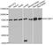 Insulin Like Growth Factor 2 MRNA Binding Protein 1 antibody, MBS126396, MyBioSource, Western Blot image 