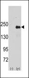 Sperm Associated Antigen 9 antibody, LS-C100867, Lifespan Biosciences, Western Blot image 