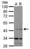 CHRNA7 (Exons 5-10) And FAM7A (Exons A-E) Fusion antibody, PA5-31823, Invitrogen Antibodies, Western Blot image 