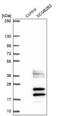 Secretoglobin Family 2B Member 2 antibody, NBP1-92367, Novus Biologicals, Western Blot image 