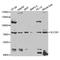 Solute Carrier Family 3 Member 1 antibody, A5500, ABclonal Technology, Western Blot image 