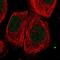 Chromosome 6 Open Reading Frame 163 antibody, NBP1-94165, Novus Biologicals, Immunocytochemistry image 
