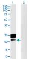 DMRT Like Family B With Proline Rich C-Terminal 1 antibody, MA5-24485, Invitrogen Antibodies, Western Blot image 