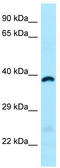 Monoacylglycerol lipase ABHD6 antibody, TA338020, Origene, Western Blot image 