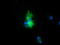 Peroxisomal targeting signal 1 receptor antibody, TA501406, Origene, Immunofluorescence image 