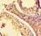 Histone-lysine N-methyltransferase SETD1A antibody, LS-C679440, Lifespan Biosciences, Immunohistochemistry paraffin image 