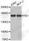 Tyrosine Kinase With Immunoglobulin Like And EGF Like Domains 1 antibody, A3334, ABclonal Technology, Western Blot image 