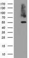 Pyruvate Kinase L/R antibody, TA501418, Origene, Western Blot image 