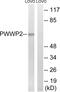 PWWP Domain Containing 2B antibody, abx014761, Abbexa, Western Blot image 