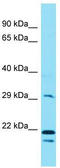 Eukaryotic Elongation Factor 2 Lysine Methyltransferase antibody, TA335332, Origene, Western Blot image 