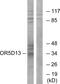 Olfactory Receptor Family 5 Subfamily D Member 13 (Gene/Pseudogene) antibody, GTX87338, GeneTex, Western Blot image 