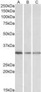 Terminal Nucleotidyltransferase 4B antibody, orb22483, Biorbyt, Western Blot image 