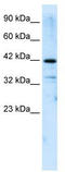 Zinc Finger And SCAN Domain Containing 31 antibody, TA341411, Origene, Western Blot image 