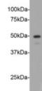 CCNE2 antibody, NBP2-67012, Novus Biologicals, Western Blot image 