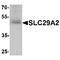 Solute Carrier Family 29 Member 2 antibody, TA349152, Origene, Western Blot image 
