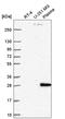 Homeobox D1 antibody, HPA056900, Atlas Antibodies, Western Blot image 