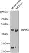 Inositol Polyphosphate-5-Phosphatase K antibody, 23-196, ProSci, Western Blot image 