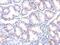 Tumor Susceptibility 101 antibody, MA1-23296, Invitrogen Antibodies, Immunohistochemistry frozen image 