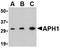 Aph-1 Homolog A, Gamma-Secretase Subunit antibody, orb74785, Biorbyt, Western Blot image 