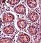Structural Maintenance Of Chromosomes 1B antibody, LS-C161311, Lifespan Biosciences, Immunohistochemistry paraffin image 