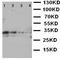 Leukocyte tyrosine kinase receptor antibody, orb137869, Biorbyt, Western Blot image 