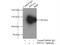 Liprin-alpha-3 antibody, 11492-1-AP, Proteintech Group, Immunoprecipitation image 