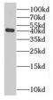 MAGE Family Member A10 antibody, FNab04935, FineTest, Western Blot image 