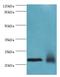 Neuronal Calcium Sensor 1 antibody, MBS968792, MyBioSource, Western Blot image 