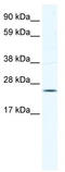 Potassium Channel Tetramerization Domain Containing 6 antibody, TA331468, Origene, Western Blot image 